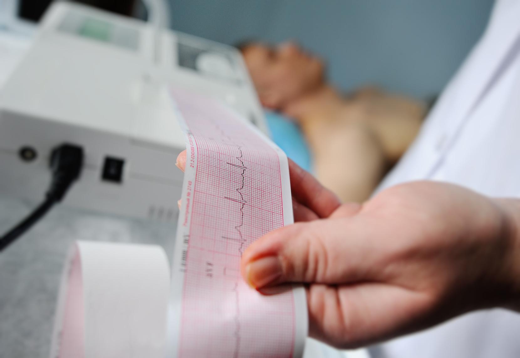 Czym jest i jak wygląda badanie EKG?